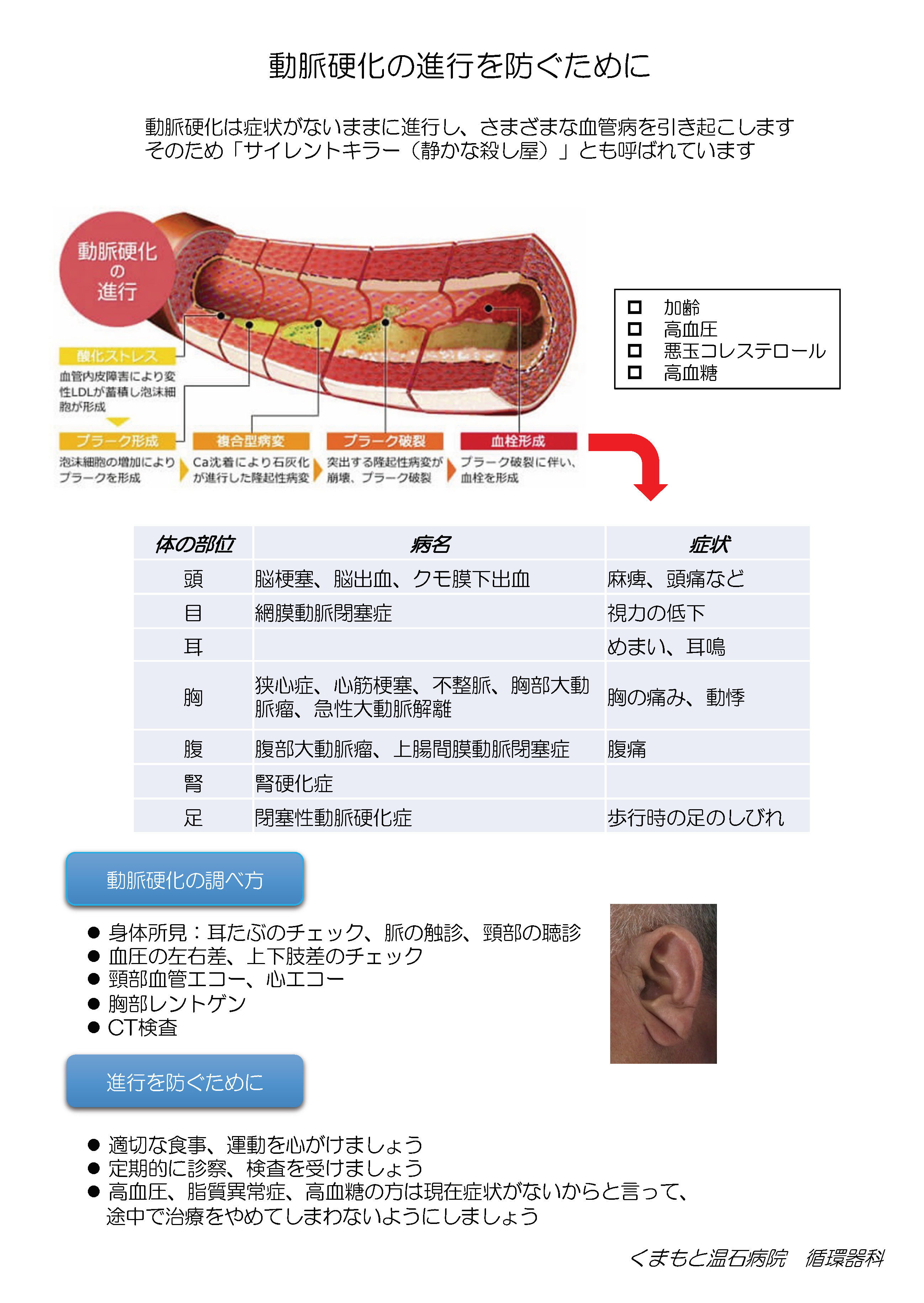 動脈硬化の進行を防ぐために.jpg