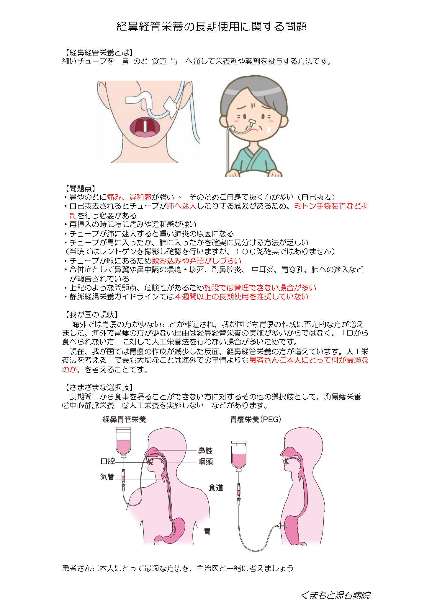 経鼻経管栄養の長期使用に関する問題.jpg